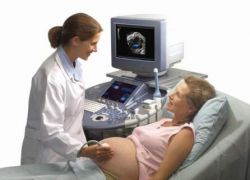 доплерометрия при беременности как делают