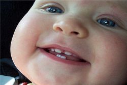 сколько молочных зубов у детей