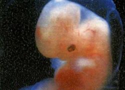 эмбрион 5 недель