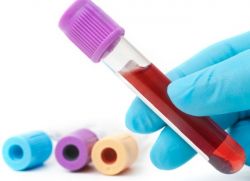 хронический лимфолейкоз анализ крови