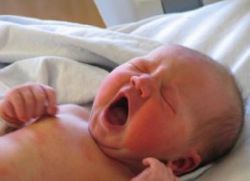 симптомы дцп у новорожденных
