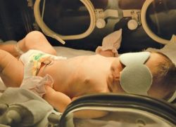 лампа для фототерапии новорожденных