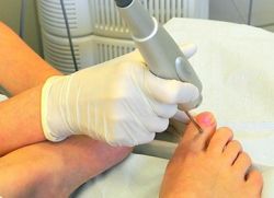 лечение ногтевого грибка на ногах