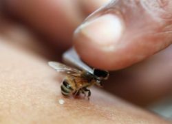 Лечение радикулита пчелами