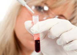 Анализ крови фибриноген повышен