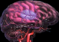 атеросклероз сосудов головного мозга симптомы