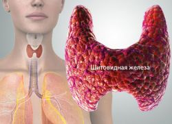Пункция щитовидной железы