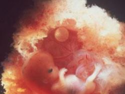 Развитие эмбриона на 7 неделе