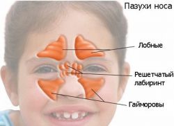 синусит у детей симптомы