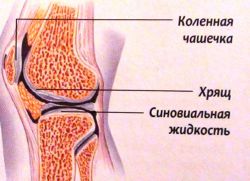 Откачивание жидкости из коленного сустава