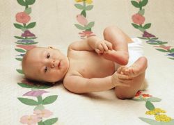 вывих тазобедренного сустава у новорожденных