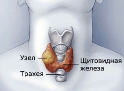 заболевания щитовидной железы у беременных