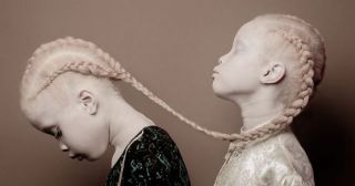 Близнецы-альбиносы покорили мир своей уникальной красотой!