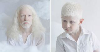 Тысяча оттенков белого на завораживающих фото с альбиносами