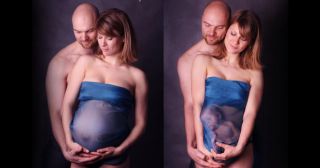 Слабонервным не смотреть: 18 жутких фото с беременными