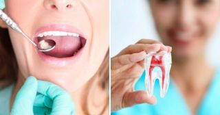 Все болезни от зубов: 9 причин дойти до дантиста