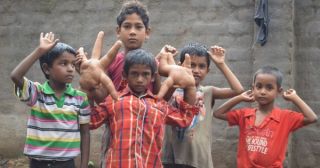 «Дитя дьявола» из Индии — мальчик с огромными руками 