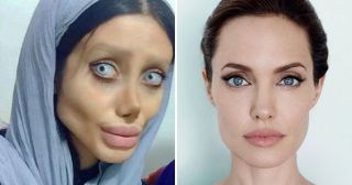 Девушка хотела стать похожей на Анджелину Джоли, у нее почти получилось, но...
