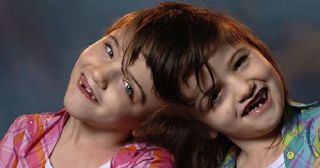 25 интереснейших фактов о близнецах