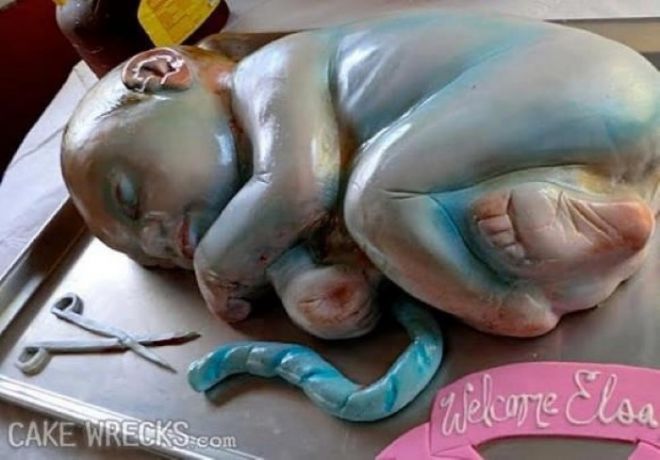 Синий младенец с пуповиной