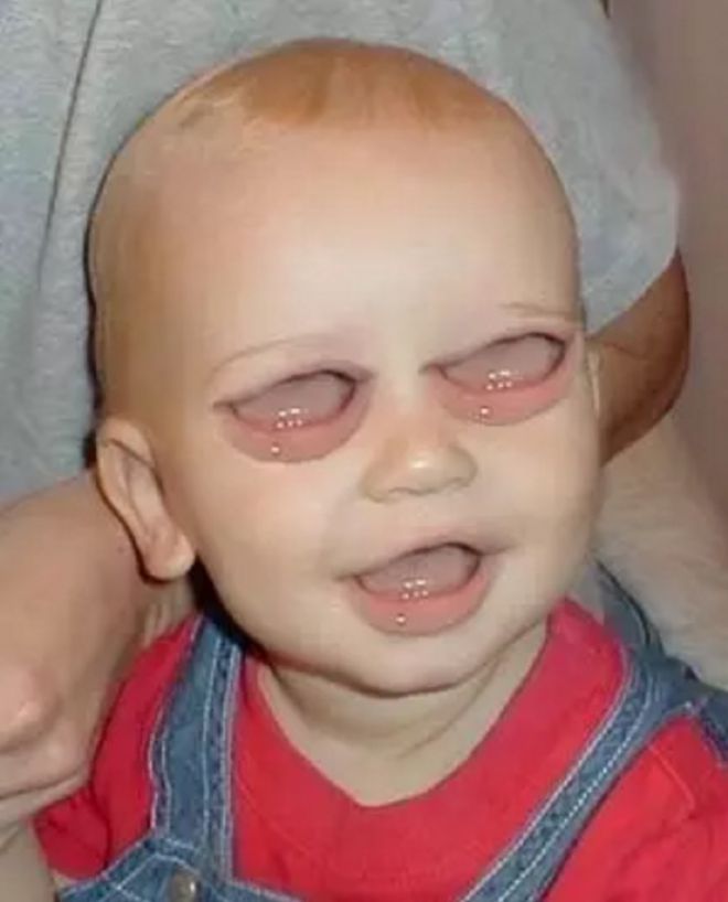 Ребенок со ртом вместо глаз