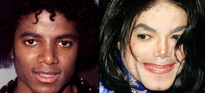 Как Майкл Джексон поменял цвет кожи?