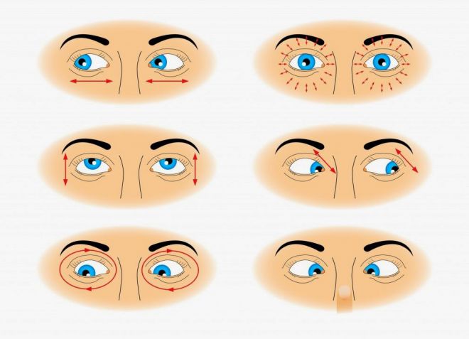 как вылечить астигматизм глаз