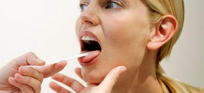 стафилококк в горле симптомы