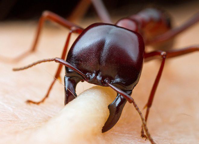 многих кусали муравьи