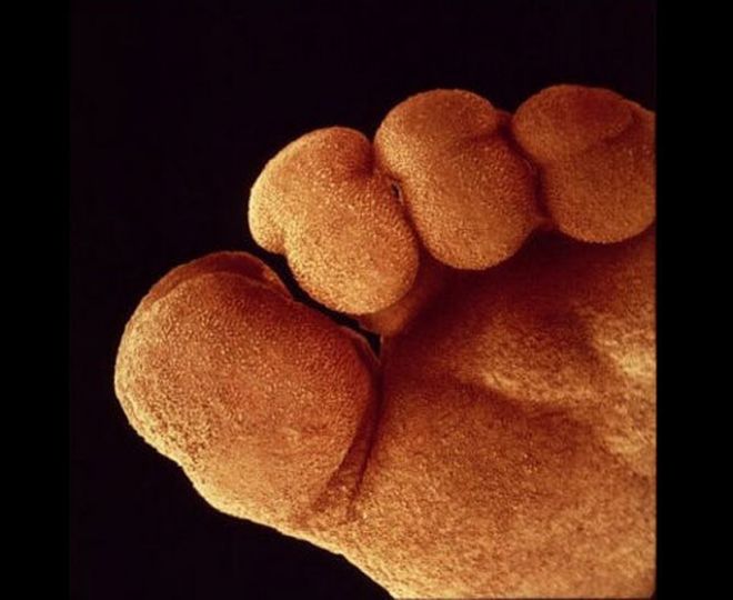 Пальцы на ножках