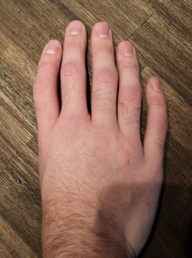 5 пальцев