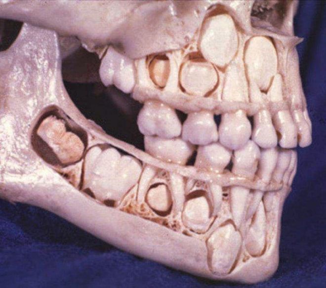 Взрослые зубы