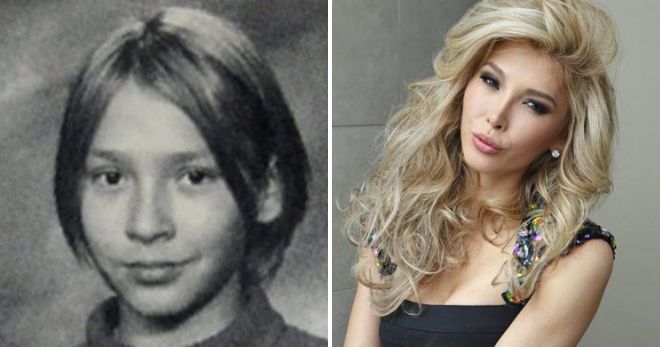 Дженна талакова фото до и после операции