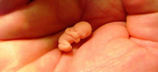 медикаментозный аборт сроки