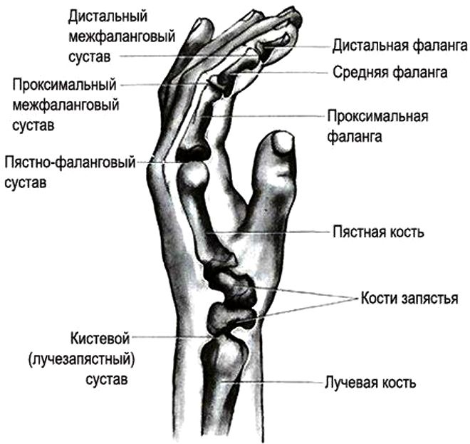 ревматоидный артрит кистей рук