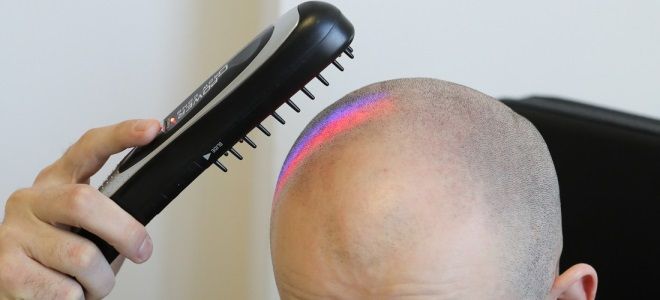 лазерная расческа для роста волос