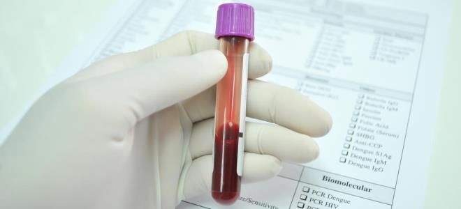 анализ крови биохимия норма