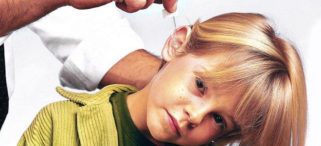 почему болят уши у детей