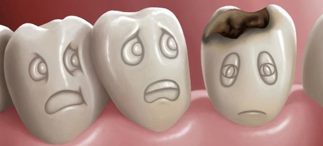 почему портятся постоянные зубы у ребенка