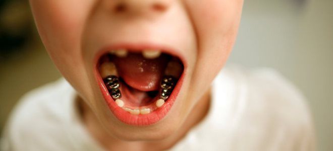 серебрение зубов у детей