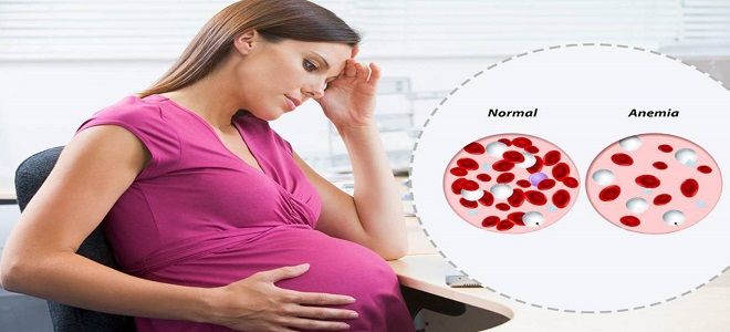 анемия у беременных