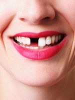 К чему снится выпадение зубов?