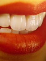 Какие коронки на зубы лучше?