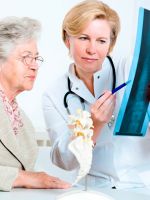 Лечение остеопороза у пожилых женщин