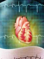 Аритмия сердца - лечение