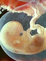 Эмбрион – 7 недель