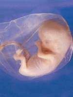 Эмбрион 8 недель