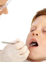 Герметизация зубов у детей