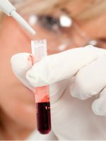 Как определить группу крови?