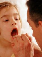Лечение тонзиллита у детей
